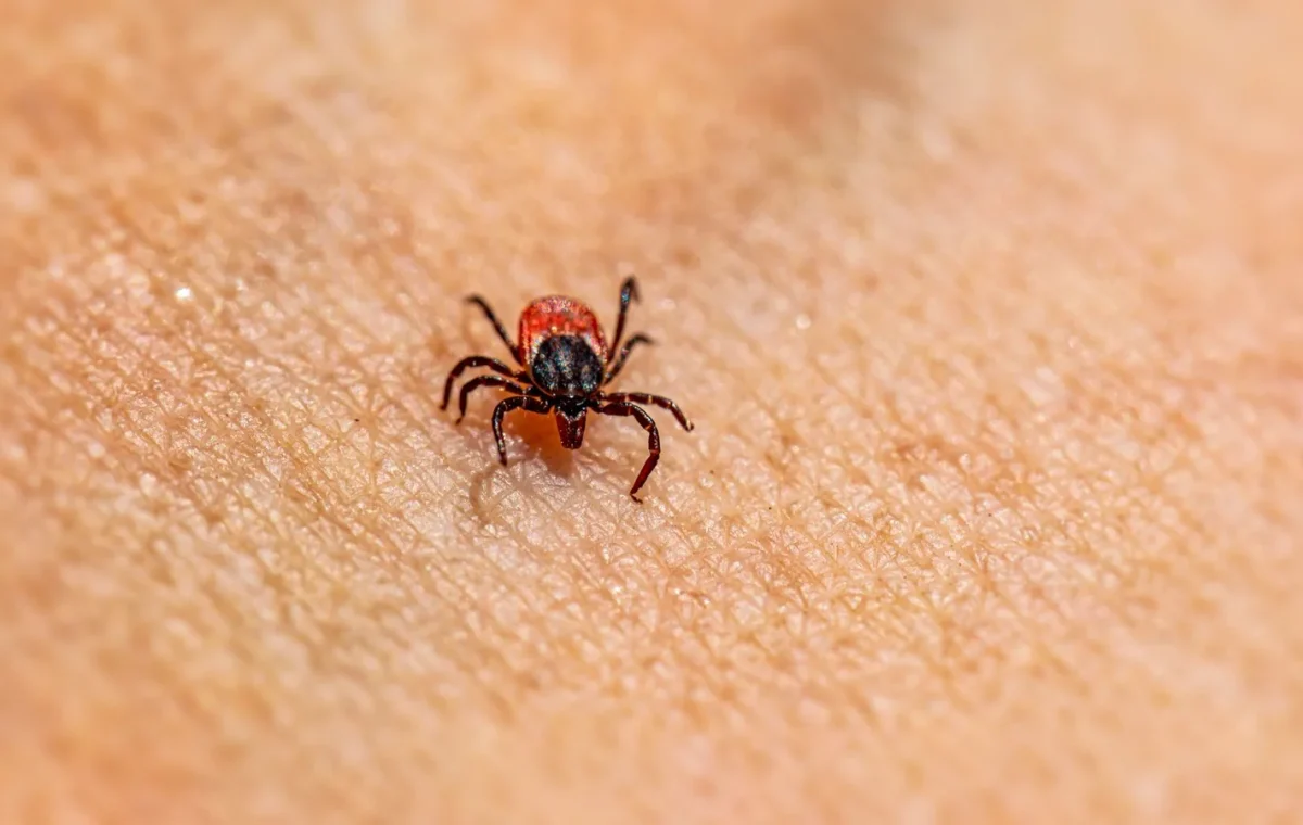 Lyme Hastalığı ve Kenelerin Vücutta Bıraktığı Dermatolojik İzler