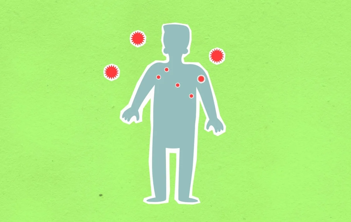 Paper cutout of male silhouette surrounded with many spreading contagious red viruses on green background during dangerous coronavirus disease outbreak